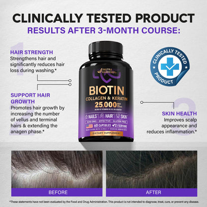 Biotin | Collagen | Keratin - Hair Growth Support - Skin & Nails Complex 25000 mcg