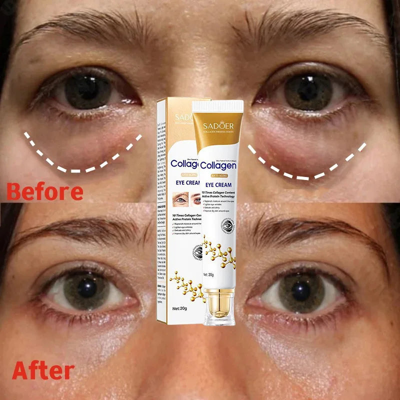 Instant Eye Bag Removal Cream