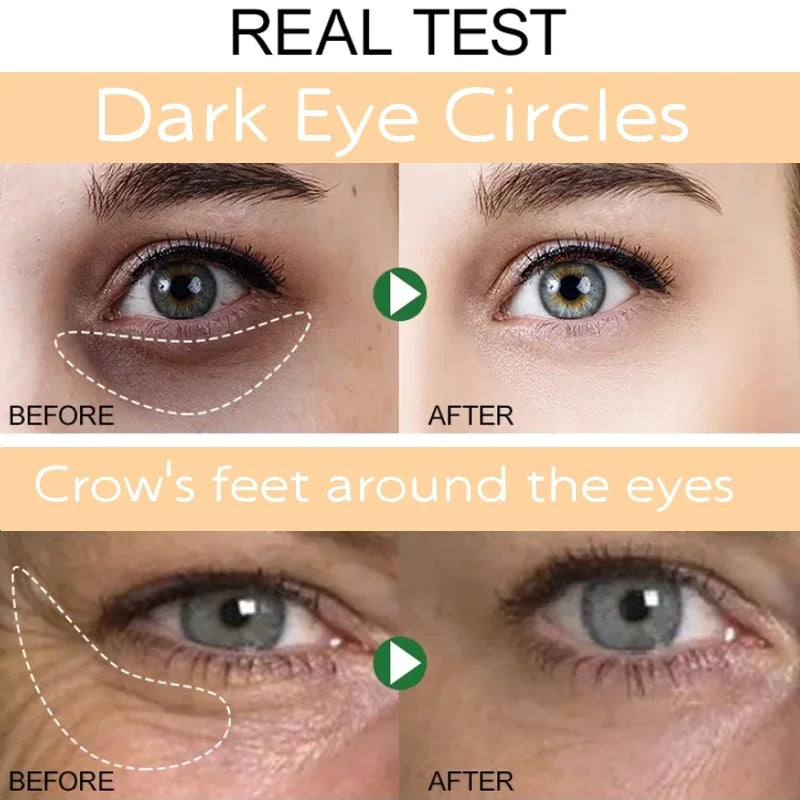 Instant Eye Bag Removal Cream