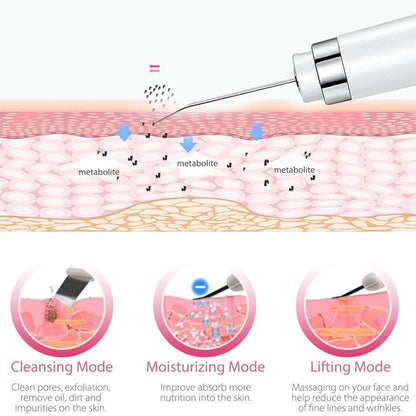 Ultrasonic Pore Deep Cleanser Acne Blackhead Remover Device