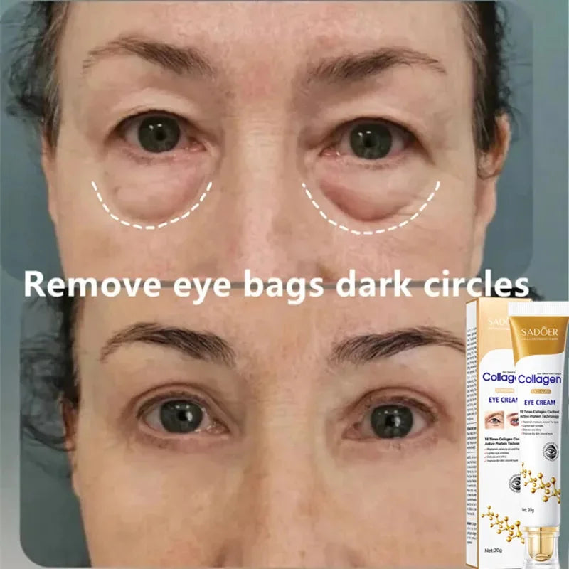 Instant Eye Bag Removal Cream