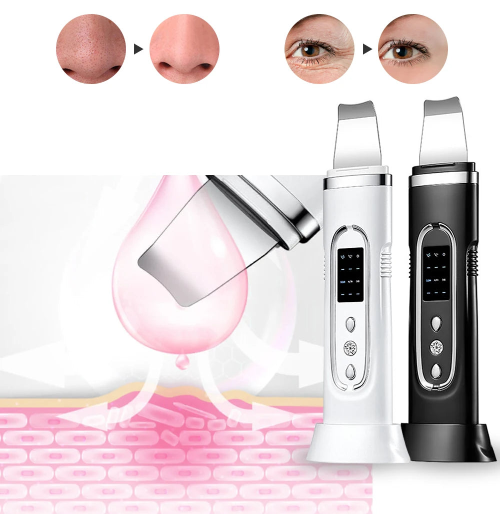 Ultrasonic Pore Deep Cleanser Acne Blackhead Remover Device